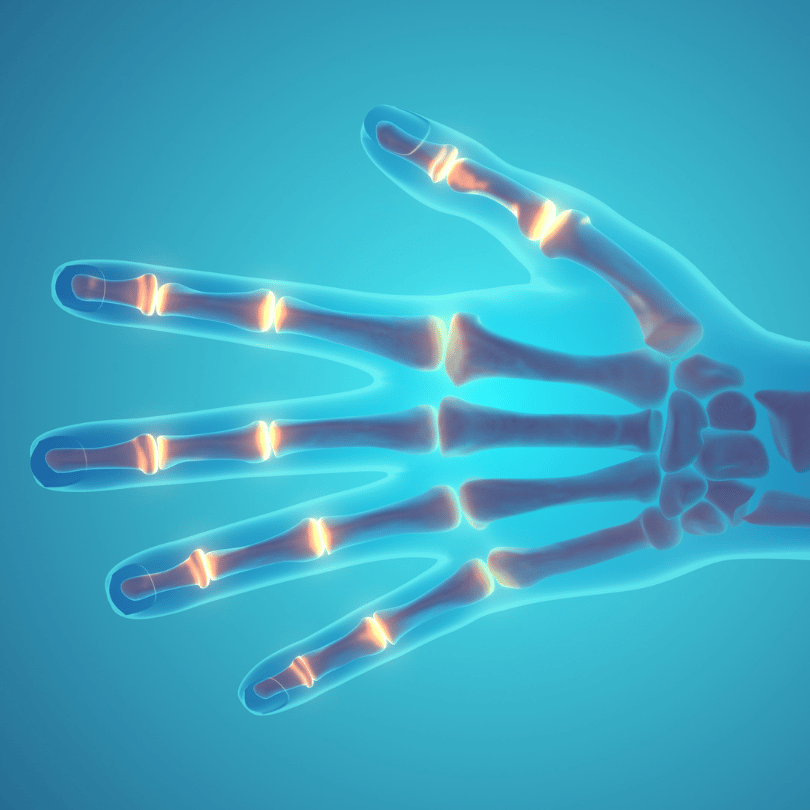 X-ray view of hand joints highlighted in red, symbolizing the anti-inflammatory and pain-relief properties of Galangal Root (Alpinia galanga) on Zaira Natural.