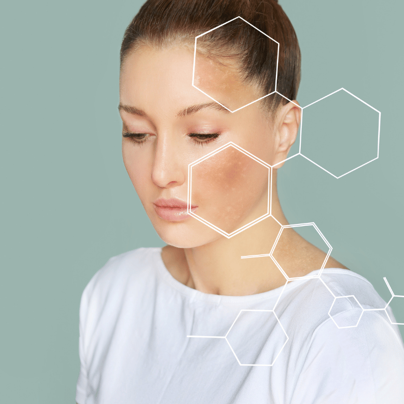 Woman with a clear complexion, representing the skin health and detoxification benefits of Zaira Natural’s Swedish Herbs Mix.